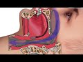 What causes obstructive sleep apnea and using jaw surgery to treat it