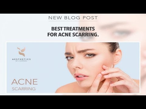 Best Skin Care Products  Dermology Acne Treatment