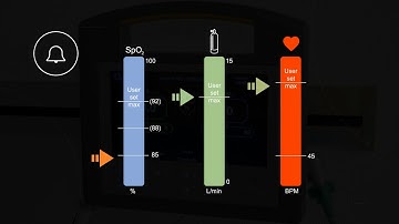Automated oxygen control with O2matic®- Video Abstract ID 183762