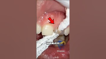 Dental Floss Under The MICROSCOPE 😱