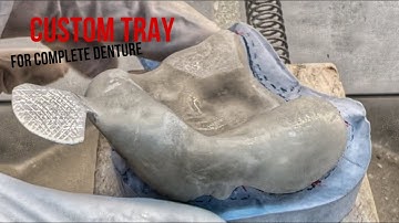Removable DENTURE - Custom Tray for Perfect Impression