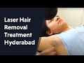 Laser Hair Removal In Hyderabad | Permanent Hair Removal Treatment In Hyderabad