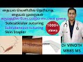 Subcutaneous suturing | Subcuticular suturing | Skin Stapler |தையல் வெளியில் தெரியாத தையல் முறைகள்