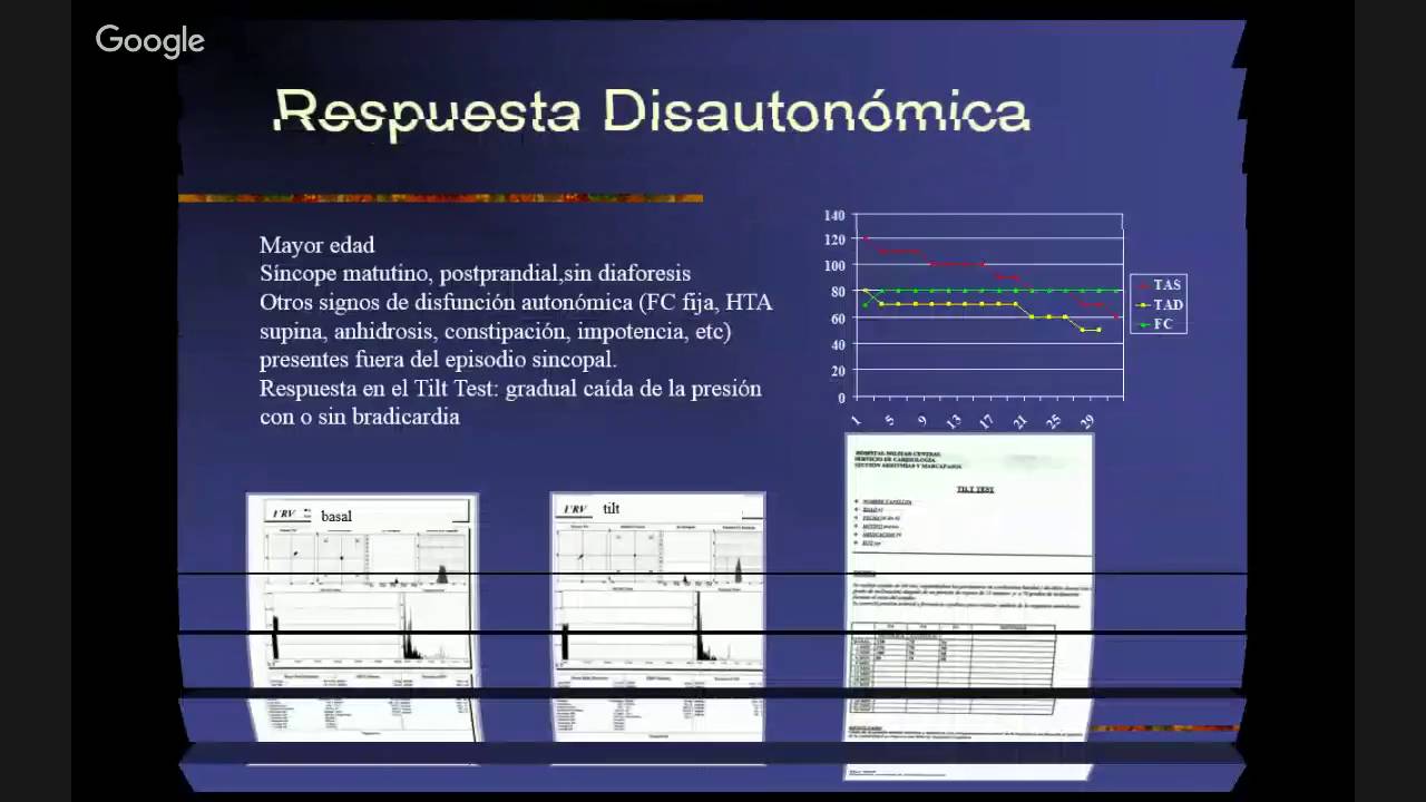 Liga Acadêmica de Cardiologia - LAC UNISC - O que é Tilt-test? O Teste de  Inclinação (TI) é um método muito utilizado para a investigação de síncope,  pré-síncopes, tonturas, palpitações relacionadas ao