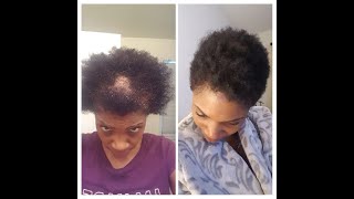 How I Regrew my Hair with Viviscal Pro Final