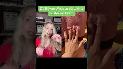 Dermatologist on what to do with a blistering burn #Shorts