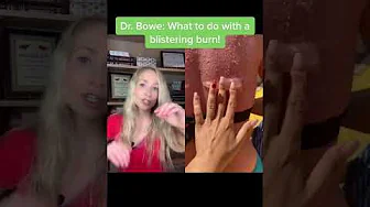 Dermatologist on what to do with a blistering burn #Shorts Dermatologist on what to do with a blistering burn #Shorts