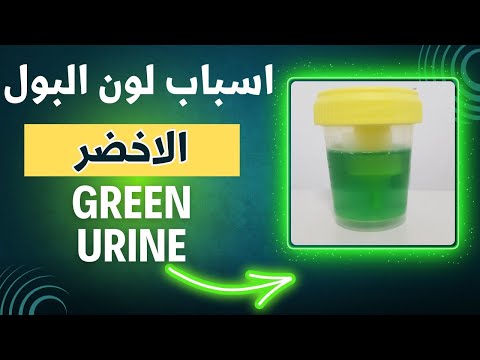 18 ما هي اسباب اللون الاخضر لعينة البول    