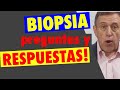 Biopsia de próstata. Preguntas y respuestas