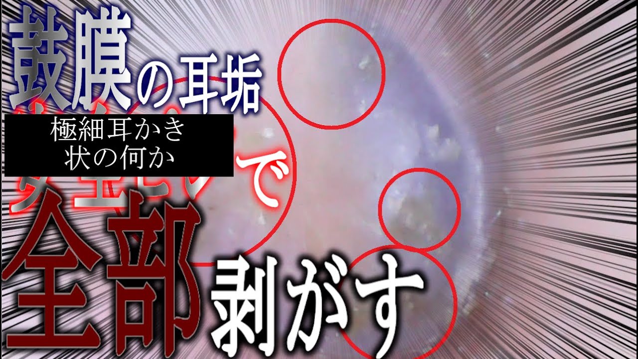 耳かき動画 鼓膜極細耳かき状の何か回 後にスパイラル耳かき使用レビュー 過去動画再アップ Youtube 耳かき動画 鼓膜極細耳かき状の何か回 後にスパイラル耳かき使用レビュー 過去動画再アップ Youtube