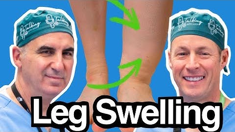 Swollen Leg After Surgery - Best Ways To Reduce It