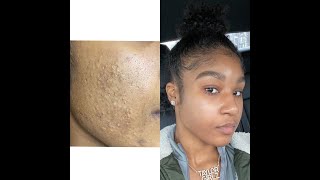 ti underneath skin care