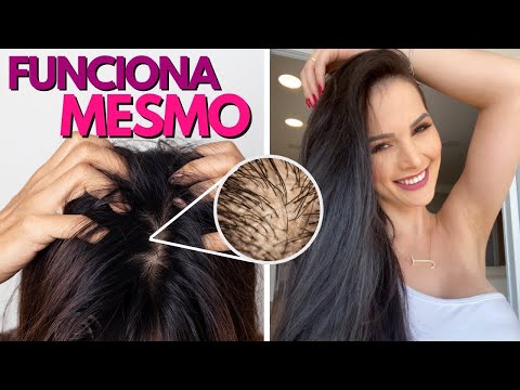 Vídeo: 12 maneiras de evitar que o cabelo fique oleoso