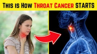 This is How Throat Cancer STARTS and No One Tells You - 10 Symptoms