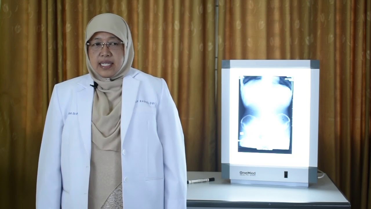 Pembacaan Foto BNO   dr  Nurul Machillah, SpRad