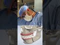 Before you Spend Money on Fillers or Implants, Watch this