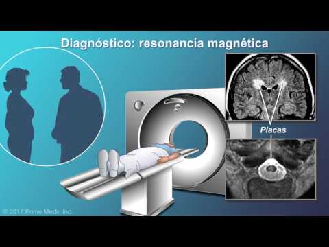 Vídeo: Diagnóstico De Esclerosis Múltiple: Proceso, Procedimientos, Pruebas