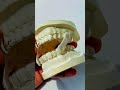 At DentaVIBE Revolutionizing Smiles with Laser Dentistry & More!