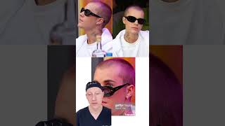 Justin Bieber's NEW Hairline | Plastic Surgeon Reacts