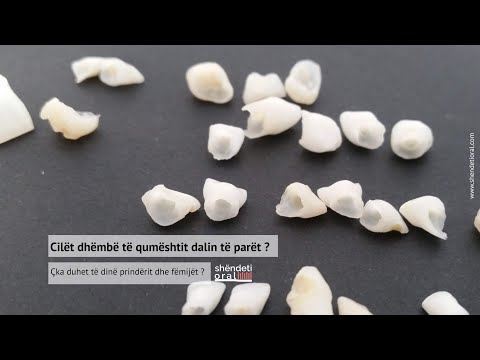 Video: A shkakton ethe dalja e dhëmbëve?