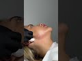 Хочешь добиться идеального профиля Джоли? 💋Это возможно с помощью инъекционной косметологии!
