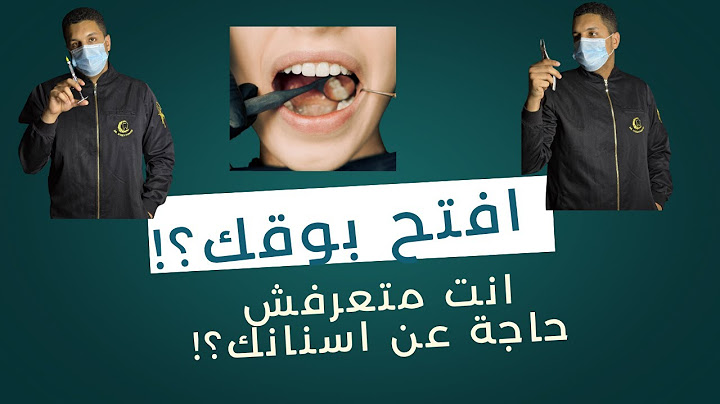 افتح بوقك ؟!..كل حاجة محتاج تعرفها عن اسنانك
