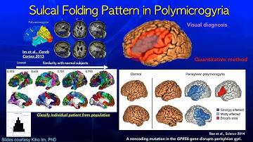 ISMRM MR Academy - Taking Imaging To The Next Level: Structural Insights Using Surface Based & ...