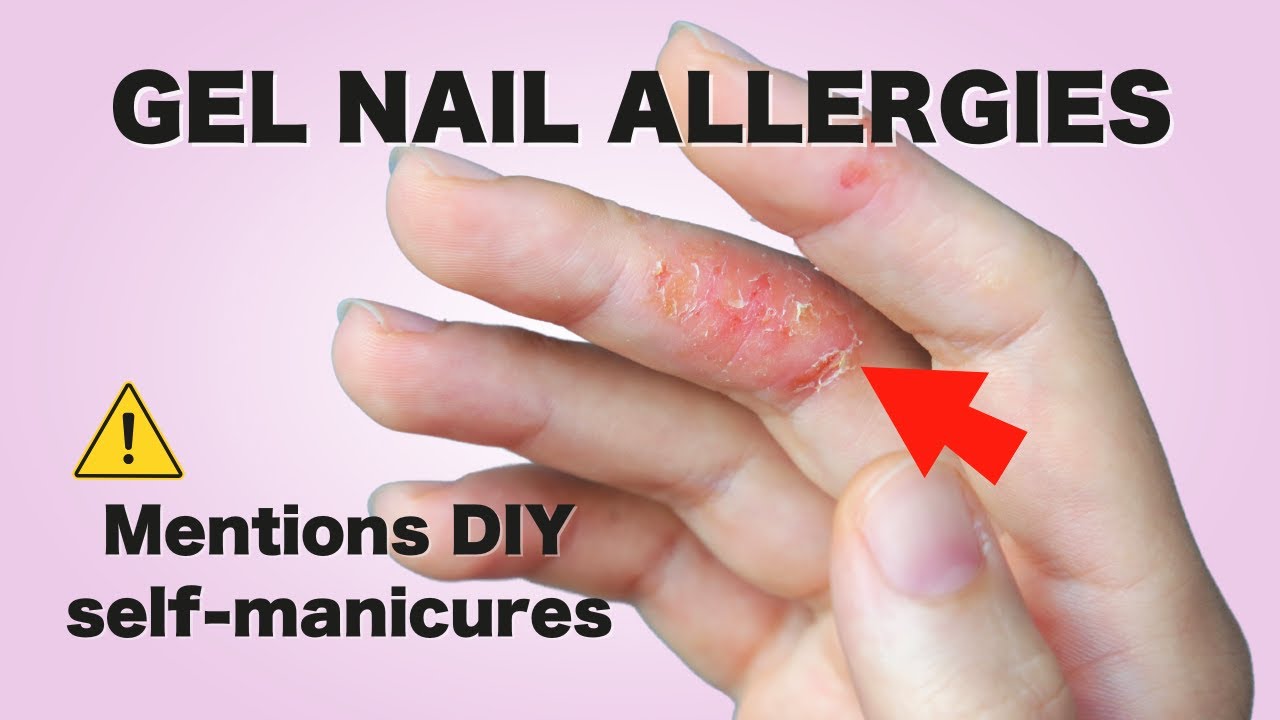Avoid Gel Nail Allergies Professional Safety Tips for DIY Nail