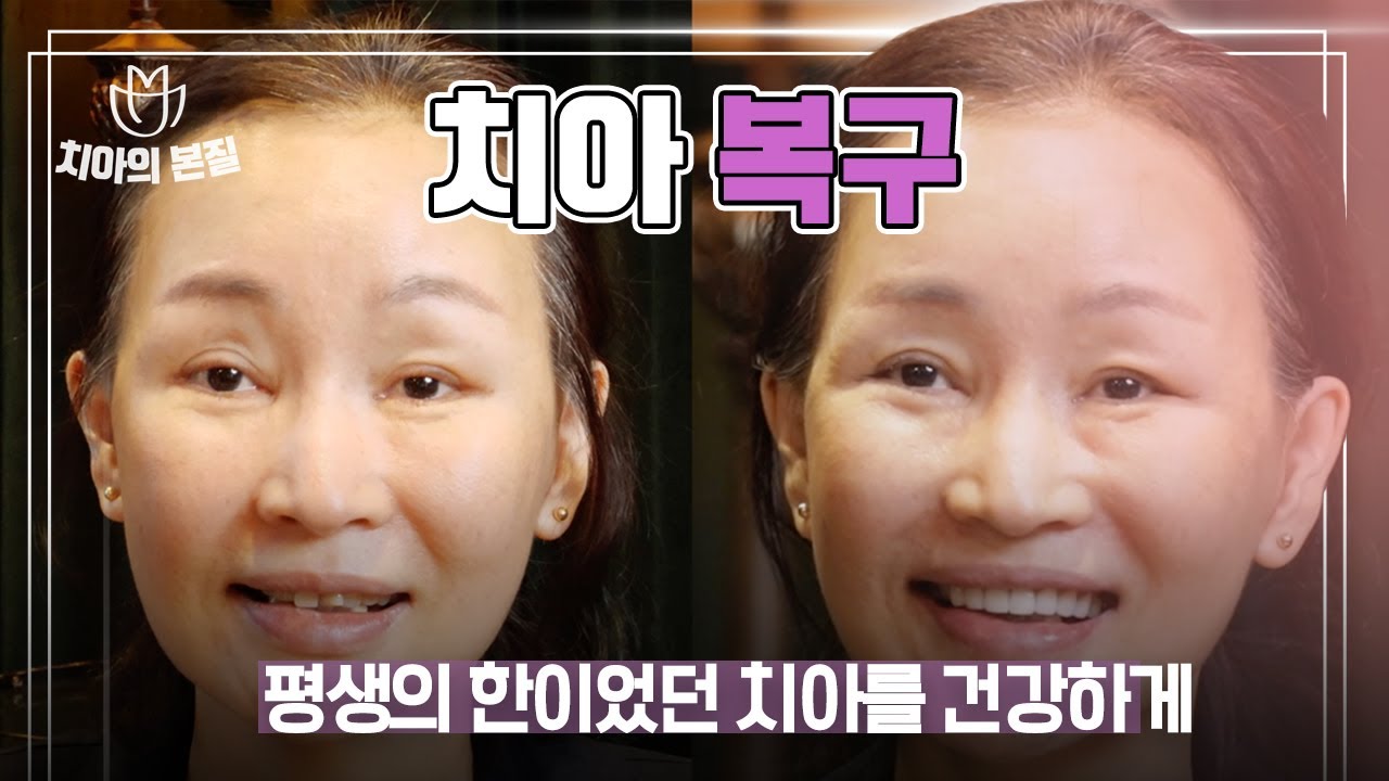 잘못된 부분틀니 방치? 치아복구 이렇게 했습니다 [엄마는예뻤다]