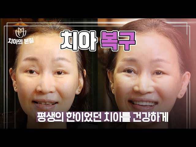 잘못된 부분틀니 방치? 치아복구 이렇게 했습니다 [엄마는예뻤다]