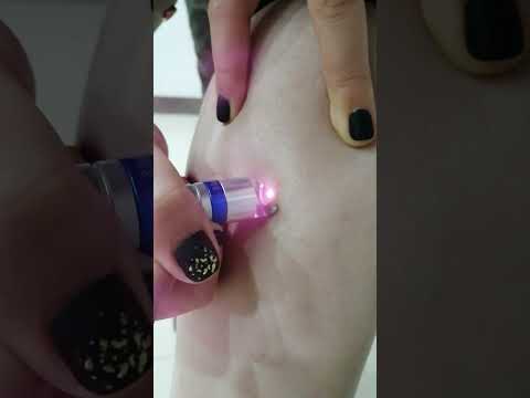 980nm Laser Spider