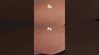 Péče O Strie S Lr Health Beauty Aloe Vera Hydratace A Pevná Pokožka