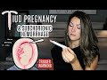 IUD PREGNANCY | Threatened Miscarriage | SUBCHORIONIC BLEEDING DURING PREGNANCY