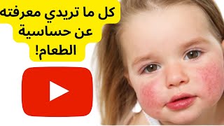 علاج حساسية الطعام عند الأطفال | نصائح مفيدة للأمهات