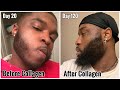 Collagen is what your beard has been missing... life changing !