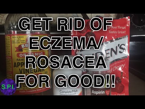 THE BEST CURE FOR ECZEMA/ROSACEA: DON&rsquo;T WORRY ABOUT RED DRY SKIN EVER AGAIN!!!