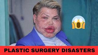 15 Celebrities Before and After Plastic Surgery | Then and Now 2026 😱