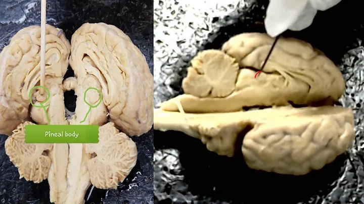 anatomy of the sheep brain video for anatomy class...