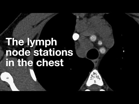 The Lymph Node Stations in the Chest