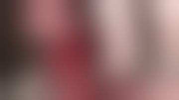 Surgery Preview Video: Extraction Site Management Course - Titanium Reinforced Membrane