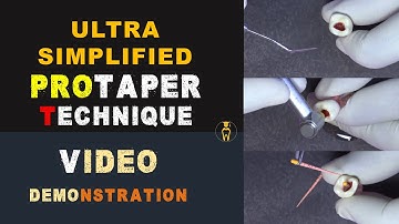 Ultra Simplified Protaper Technique : Video demonstration