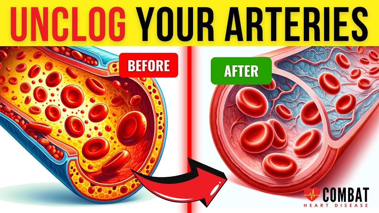 10 Foods That Unclog Arteries NATURALLY and Prevent Heart Attacks