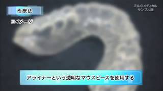 マウスピース矯正／ミルメディカル　家庭の医学動画版