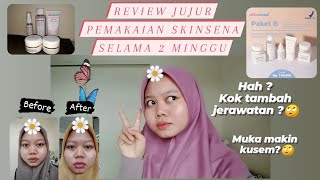 REVIEW JUJUR pemakaian SKINSENA dan hasilnya...