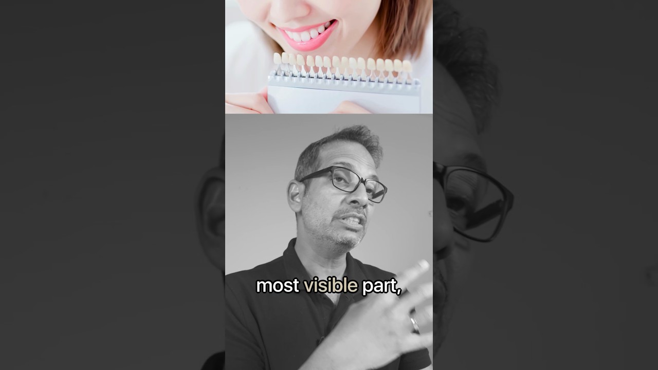 Not everyone knows this dental hack. #dentalhacks #dentalsecrets #smiletransformation
