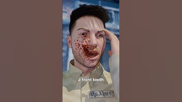 A Bullet Stopped By A Tooth 😱