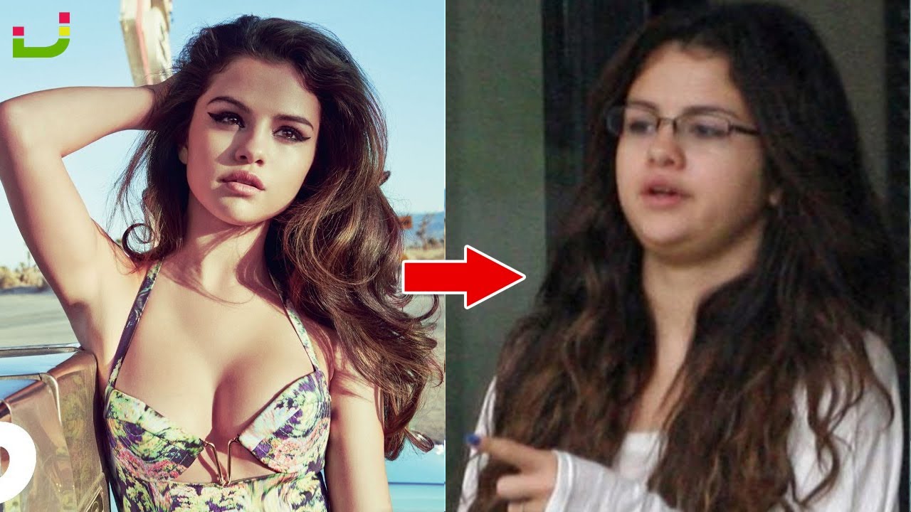 Shocking Celebrities Without Makeup