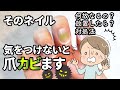 そのネイル、実はカビてるかも？知らないとヤバい“グリーンネイル”の真実を原因・症状・対処法を業界20年/元プロネイリストが解説！