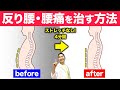 反り腰・腰の痛み・ぽっこりお腹が改善した骨格のしくみとセルフケアを紹介します！