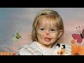 【衝撃】少女は子供の時、顔の半分を食べられた。11年後、少女の人生は劇的な変化を遂げる。思わず二度見する